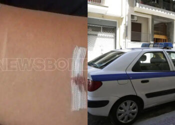 Δεν λειτούργησε το panic button: Την ξυλοκόπησε και τη διέσυρε με ροζ βίντεο και τώρα τη μαχαίρωσε – Αναζητείται ο δράστης