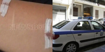Alldaynews.gr Δεν λειτούργησε το panic button: Την ξυλοκόπησε και τη διέσυρε με ροζ βίντεο και τώρα τη μαχαίρωσε – Αναζητείται ο δράστης