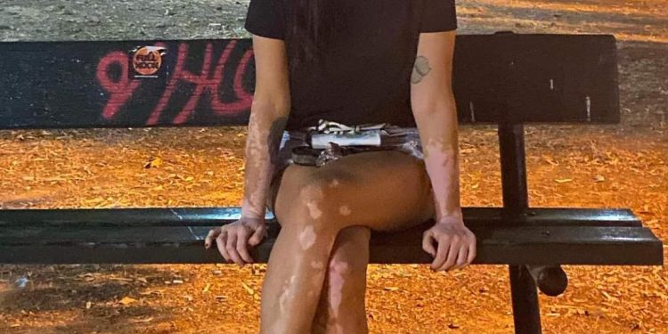 Φωτιά στην Αττική: Συγκλονίζουν οι φωτογραφίες της Αθηναΐδος Νέγκα μέσα από τις στάχτες