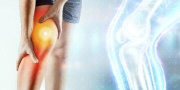 Ρήξη Πρόσθιου και Οπίσθιου Χιαστού. Η Αρθροσκόπηση για την πλήρη επαναφορά και λειτουργία του γoνάτου