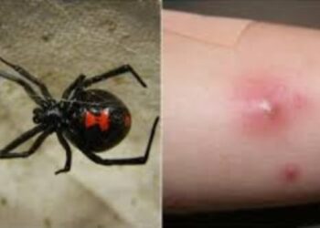 Alldaynews.gr Τραγωδία: Πέθανε ο 48χρονος που τον είχε τσιμπήσει αράχνη – Είχε πάει διακοπές