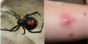 Alldaynews.gr Τραγωδία: Πέθανε ο 48χρονος που τον είχε τσιμπήσει αράχνη – Είχε πάει διακοπές