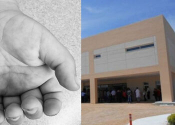 Σπαρακτικά τα λόγια του γιατρού που προσπαθούσε επί 1,5 ώρα να σώσει το 15 μηνών αγοράκι – «Πιθανόν πέθανε από…»