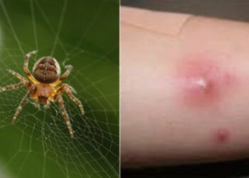 Alldaynews.gr Σοκ από τον θάνατο του 48χρονου από τσίμπημα καφέ αράχνης – Δεν υπάρχει αντίδοτο – Από ταχυπαλμίες έως οξεία νεφρική ανεπάρκεια