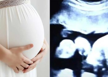 52χρονη είναι έγκuος στα δίδυμα παιδιά του γαμπρού της – Όταν όμως οι γιατροί είδαν τον τελευταίο υπέρηχο «πάγωσαν»