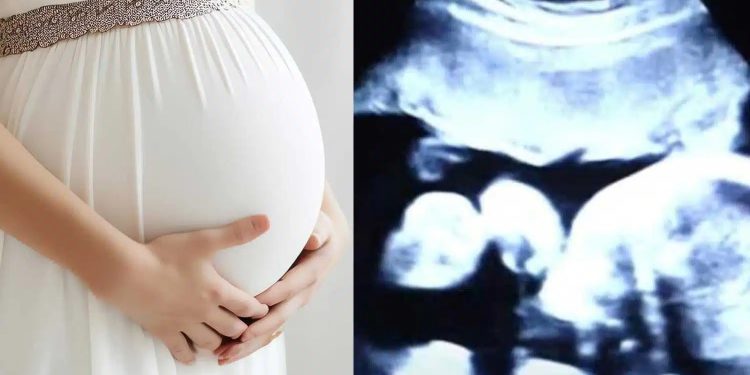 Alldaynews.gr 52χρονη είναι έγκuος στα δίδυμα παιδιά του γαμπρού της – Όταν όμως οι γιατροί είδαν τον τελευταίο υπέρηχο «πάγωσαν»