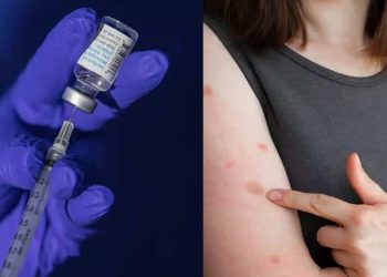 Ανοίγουν 5 εμβολιαστικά κέντρα σε όλη την Ελλάδα για την ευλογιά των πιθήκων