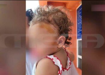 Alldaynews.gr Άγρια επίθεση από αδέσποτο σκύλο: Άρπαξε βρεφάκι 17 μηνών από το κεφάλι – Σε σοκ η μητέρα (video)