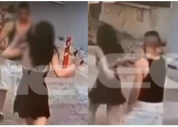 Θύμα άγριου ξυλοδαρμού 19χρονη από τον 23χρονο πρώην της: «Πίστεψα ότι θα με σκοτώσει», βίντεο ντοκουμέντο