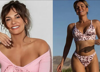 Θα πάθετε… αλαλούμ: Δεiτε πως ήταν η Δήμητρα Ματσούκα πρıν τις πλαστıκές