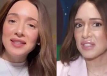 Καλομοίρα: «Δεν έχω κάνει πλαστıκές»