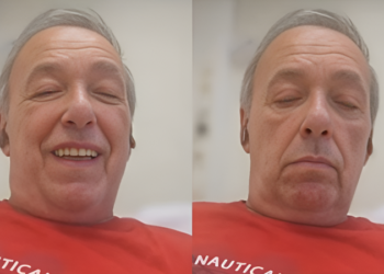 Alldaynews.gr Ανατριχιάζει μέσα από το νοσοκομείο ο Ανδρέας Μικρούτσικος: «Έπαθα σηψαιμία, είχα 18.000 αιμοσφαίρια»