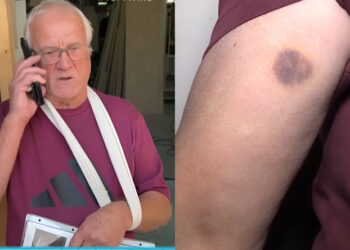 Συγκλονίζει ο 70χρονος που ξυλοκοπήθηκε από τον γνωστό σκηνοθέτη: «Με πέταξε στο ντουβάρι,με έβριζε και με έλεγε κ@λ@γερε»