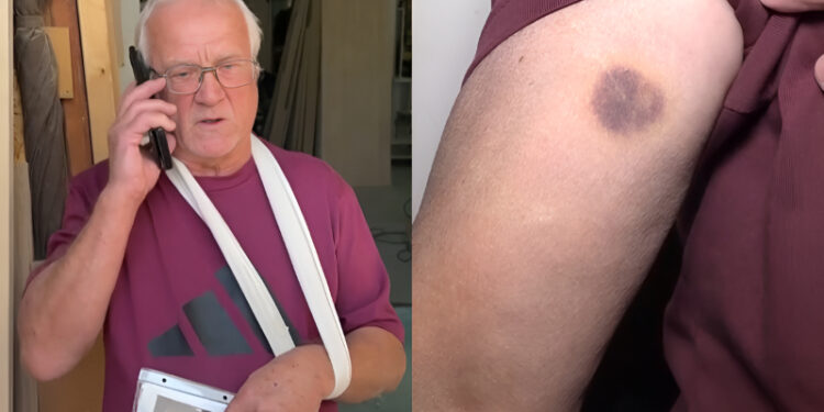 Συγκλονίζει ο 70χρονος που ξυλοκοπήθηκε από τον γνωστό σκηνοθέτη: «Με πέταξε στο ντουβάρι,με έβριζε και με έλεγε κ@λ@γερε»