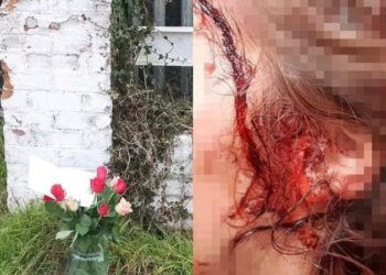 Φρίκη: 10χρονη κατακρεουργήθηκε μέχρι θανάτου από τον αγαπημένο της σκύλο (φωτο, video)