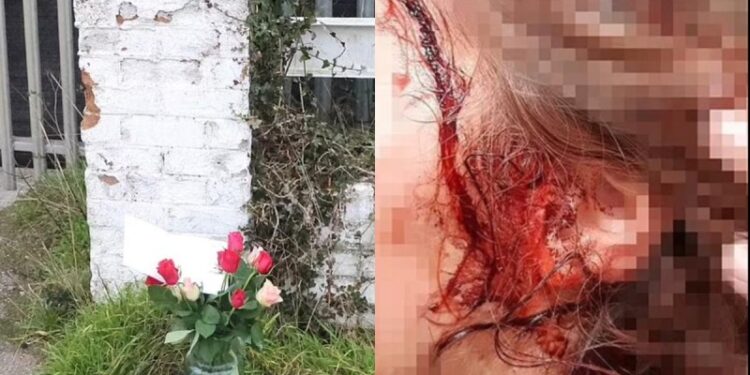 Alldaynews.gr Φρίκη: 10χρονη κατακρεουργήθηκε μέχρι θανάτου από τον αγαπημένο της σκύλο (φωτο, video)