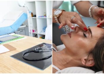 Τριπλάσια η προτίμηση των Ελλήνων σε μπότοξ και υαλουρονικό αντί για πλαστική