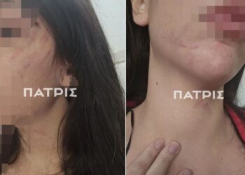 Έδεσσα: 29χρονη πήγε για διακοπές με τον σύντροφο της και έζησε τον απόλυτο εφιάλτη – Την ξυλοκόπησε βάναυσα και την παράτησε στον δρόμο