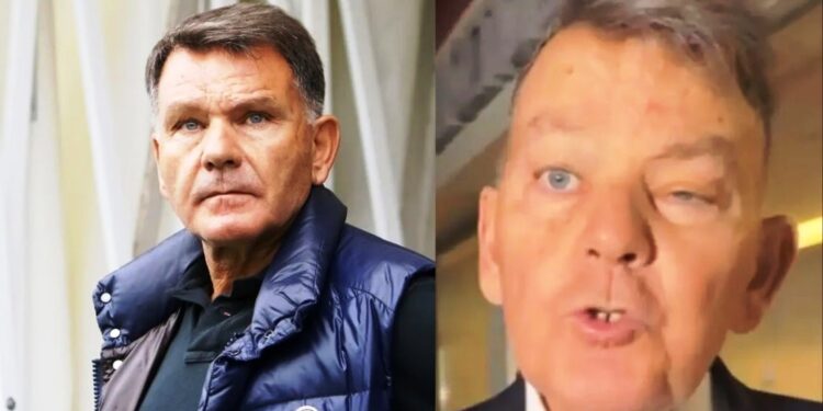 Alldaynews.gr Αγνώριστος ο Αλέξης Κούγιας – Τι του συμβαίνει