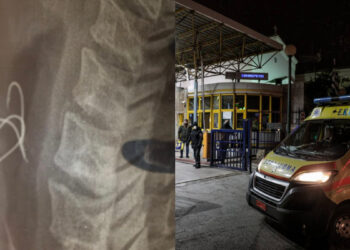 38χρονος κατανάλωσε χταπόδι με τριπλό άγκιστρο (φωτο)