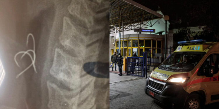 38χρονος κατανάλωσε χταπόδι με τριπλό άγκιστρο (φωτο)