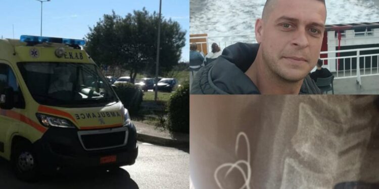 Alldaynews.gr «Πήγε στον οισοφάγο, έγινα μπλε» λέει ο 38χρονος που κατανάλωσε χταπόδι με άγκιστρο