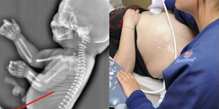 Έγκυος παίρνει την απόφαση να κάνει έκτρωση όταν βλέπει στον υπέρηχο ότι το μωρό της… – Θα σοκαριστείτε