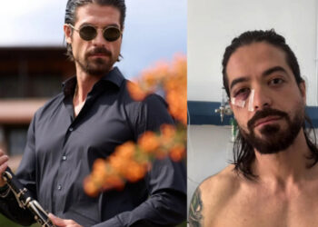 Αποκάλυψη από τον δικηγόρο του Άρη Μουγκοπέτρου: «Πήραν μόσχευμα από το μπούτι για να σώσουν τον αντίχειρα»