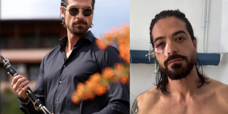 Alldaynews.gr Αποκάλυψη από τον δικηγόρο του Άρη Μουγκοπέτρου: «Πήραν μόσχευμα από το μπούτι για να σώσουν τον αντίχειρα»