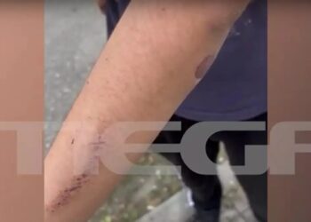 Alldaynews.gr Άγρια επίθεση από πέντε συμμαθητές του δέχτηκε 12χρονος – «Προσπαθεί να το ξεπεράσει» λέει η μητέρα του