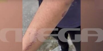 Alldaynews.gr Άγρια επίθεση από πέντε συμμαθητές του δέχτηκε 12χρονος – «Προσπαθεί να το ξεπεράσει» λέει η μητέρα του