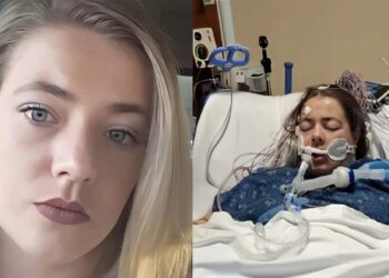 Έβγαλαν δύο λίτρα μαύρου υγρού από τους πνεύμονες 32χρονης που έκανε ηλεκτρονικό τσιγάρο