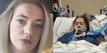 Alldaynews.gr Έβγαλαν δύο λίτρα μαύρου υγρού από τους πνεύμονες 32χρονης που έκανε ηλεκτρονικό τσιγάρο