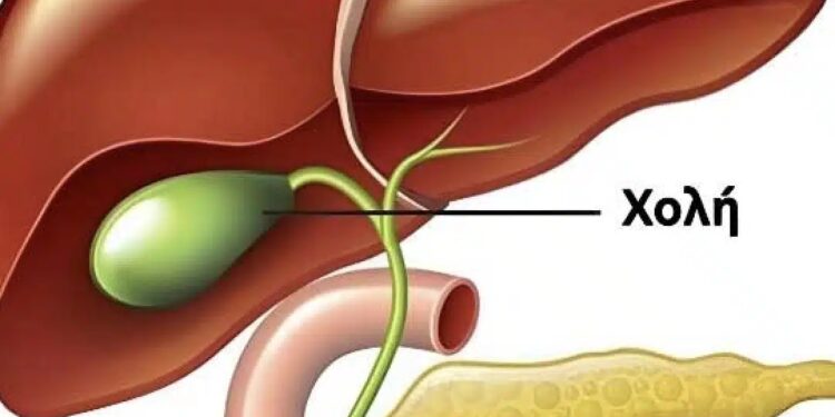 Τι συμβαίνει στο σώμα μετά την αφαίρεση της χοληδόχου κύστης; Ποιες ασθένειες εμφανίζονται μετά; Γιατί πρέπει να αποφύγετε τη χειρουργική επέμβαση;