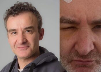 Νίκος Ορφανός: Πρησμένος και με ράμματα στο κεφάλι – Η περιπέτεια που πέρασε με την υγεία του