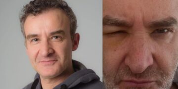 Νίκος Ορφανός: Πρησμένος και με ράμματα στο κεφάλι – Η περιπέτεια που πέρασε με την υγεία του