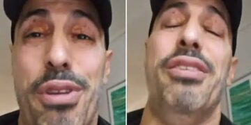 Alldaynews.gr Γιώργος Παράσχος: «Ζητώ συγγνώμη, δεν μπορώ να μιλήσω άλλο» – «Έσπασε» on air για τη μάχη του με τον καρκίνο