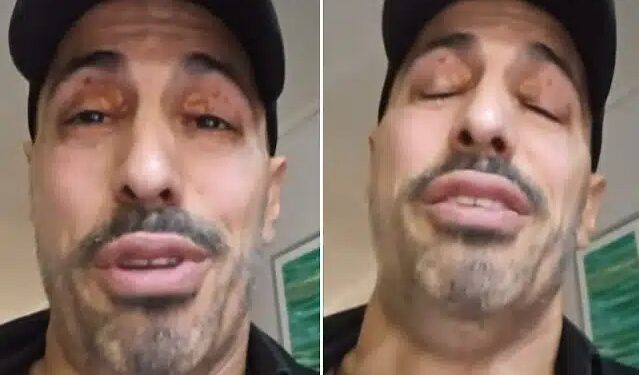 Alldaynews.gr Γιώργος Παράσχος: «Ζητώ συγγνώμη, δεν μπορώ να μιλήσω άλλο» – «Έσπασε» on air για τη μάχη του με τον καρκίνο