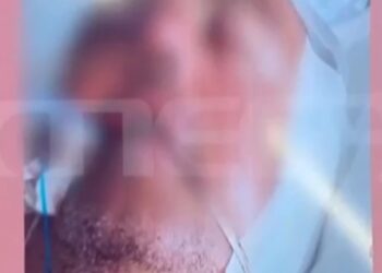 Alldaynews.gr Χαροπαλεύει ο 48χρονος που ξυλοκοπήθηκε στα Γλυκά Νερά – Άπορη η μητέρα του, ζει χωρίς ρεύμα