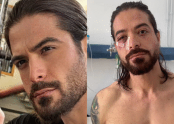 Άρης Μουγκοπέτρος: Έρχονται τεχνητά μέλη από την Αμερική για να αντιμετωπίσει τον τραυματισμό του