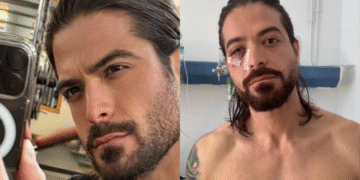 Άρης Μουγκοπέτρος: Έρχονται τεχνητά μέλη από την Αμερική για να αντιμετωπίσει τον τραυματισμό του