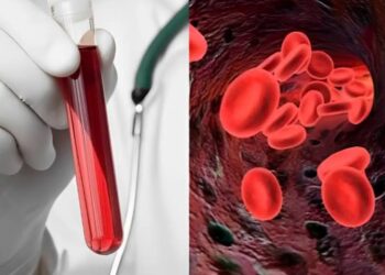 Αιματοκρίτης: Οι φυσιολογικές τιμές ανά ηλικία – Τι πρέπει να τρώτε για να τον αυξήσετε