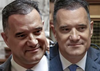 Άδωνις Γεωργιάδης: Ναι, έκανα μεταμόσχευση μαλλιών και είμαι πολύ ευχαριστημένος