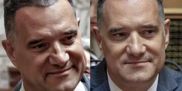 Alldaynews.gr Άδωνις Γεωργιάδης: Ναι, έκανα μεταμόσχευση μαλλιών και είμαι πολύ ευχαριστημένος
