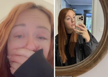 «Μια μικρή ελιά στη μύτη μου εξελίχθηκε σε μεγάλη μαύρη τρύπα» – Τα σημάδια του καρκίνου του δέρματος που εμφανίστηκαν στο πρόσωπο της 35χρονης