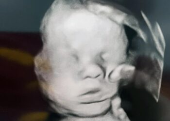 Ανατριχίλα! – «Το Χέρι του Θεού»: Μητέρα ισχυρίζεται ότι εμφανίζεται μυστηριωδώς σε υπερηχογράφημα του μωρού – Προσευχόταν για την υγεία του