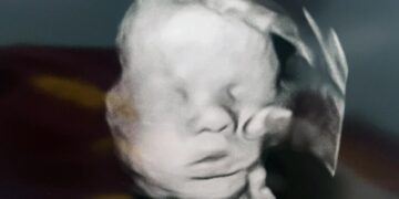 Ανατριχίλα! – «Το Χέρι του Θεού»: Μητέρα ισχυρίζεται ότι εμφανίζεται μυστηριωδώς σε υπερηχογράφημα του μωρού – Προσευχόταν για την υγεία του