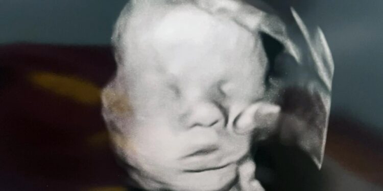 Ανατριχίλα! – «Το Χέρι του Θεού»: Μητέρα ισχυρίζεται ότι εμφανίζεται μυστηριωδώς σε υπερηχογράφημα του μωρού – Προσευχόταν για την υγεία του