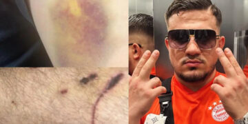 «Ο Ivan Greko έβαλε το πιστόλι στον κρόταφο του παιδιού μου» λέει ο πατέρας του 24χρονου που έπεσε θύμα απαγωγής από τη συμμορία του τράπερ