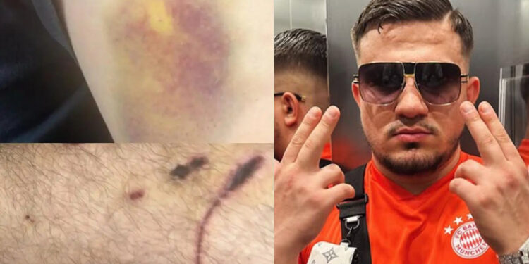 «Ο Ivan Greko έβαλε το πιστόλι στον κρόταφο του παιδιού μου» λέει ο πατέρας του 24χρονου που έπεσε θύμα απαγωγής από τη συμμορία του τράπερ